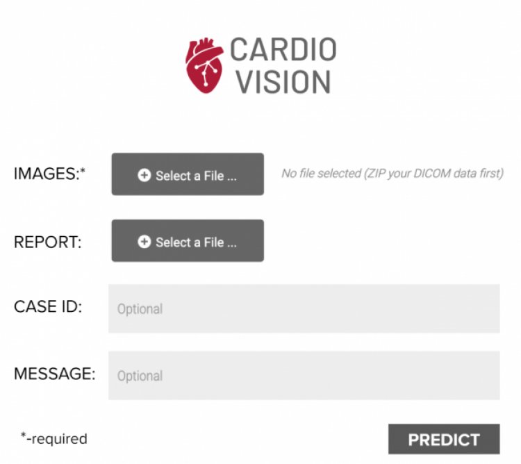 Український стартап Cardio Vision розробив сервіс для боротьби із хворобами серця